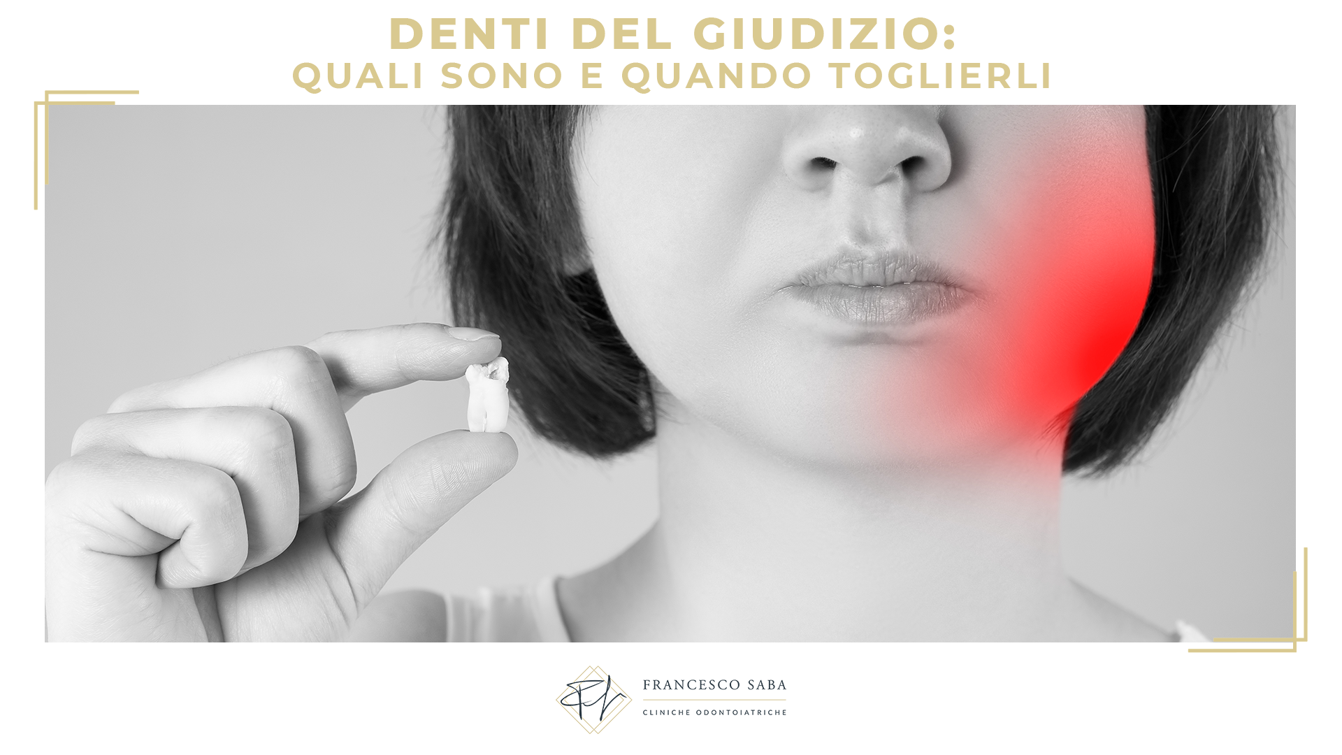 Denti del giudizio: quali sono e quando toglierli