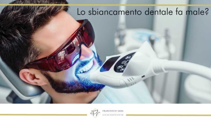 Lo sbiancamento dentale fa male | Francesco Saba